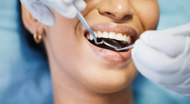 Best Broken Tooth Emergency  in Cherry Grove, OH