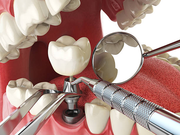 Best Urgent Tooth Repair  in Cherry Grove, OH